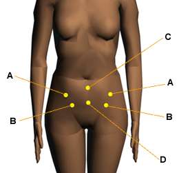 Menstrual pain: Sacral Points