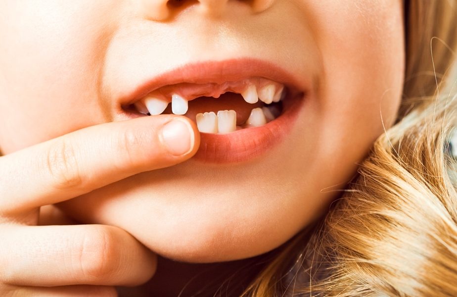 Common Dental Problems in Children